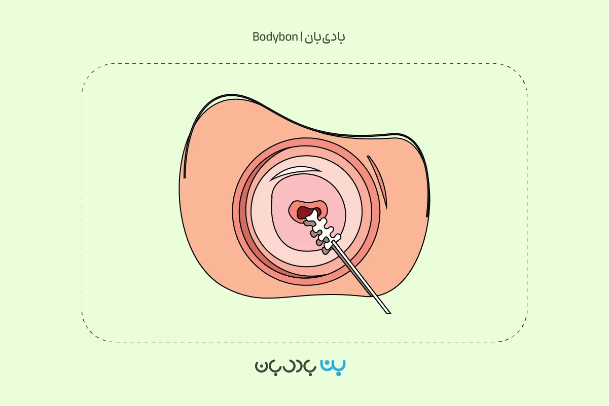 pap smear test analysis 1