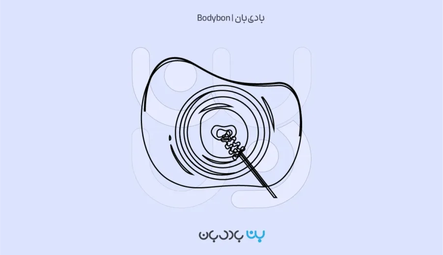 تفسیر آزمایش پاپ اسمیر؛ راهنمای کامل پیشگیری از سرطان دهانه رحم
