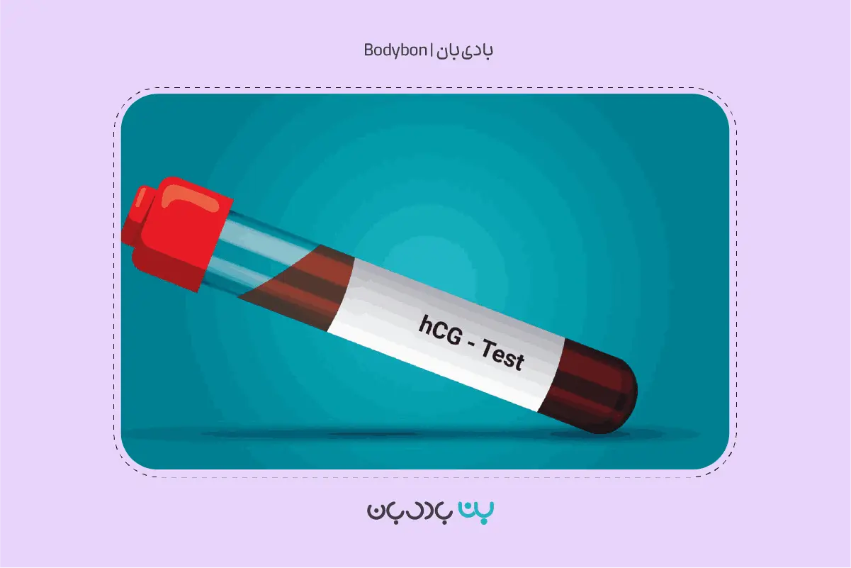 آزمایش دابل مارکر یا تست نشانگر دوگانه چیست؟ 3 استفاده از مارکر هورمون hCG در آزمایش دابل مارکر