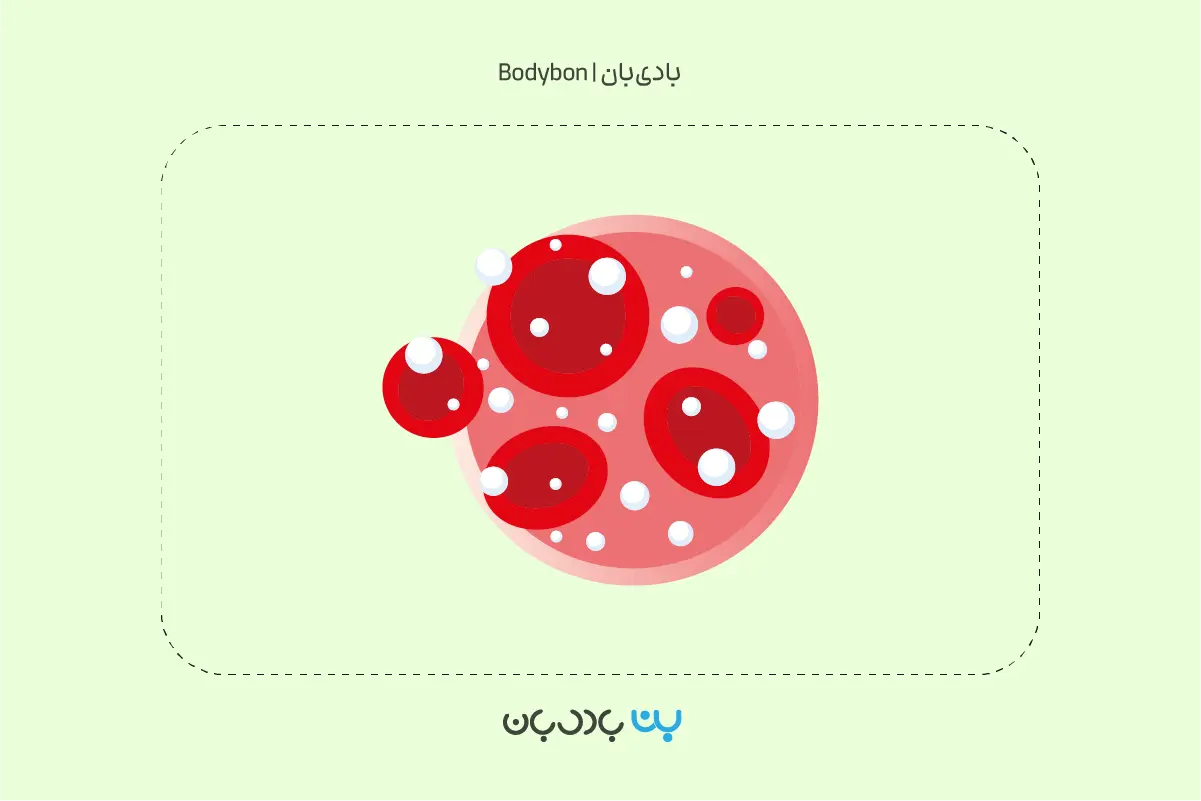 تفسیر آزمایش قند خون ناشتا یا آزمایش FBS 2 قند خون نرمال در تفسیر آزمایش قند خون ناشتا چقدر است؟ قند خون کمتر از ۱۰۰ نشاندهنده قند خون طبیعی است.