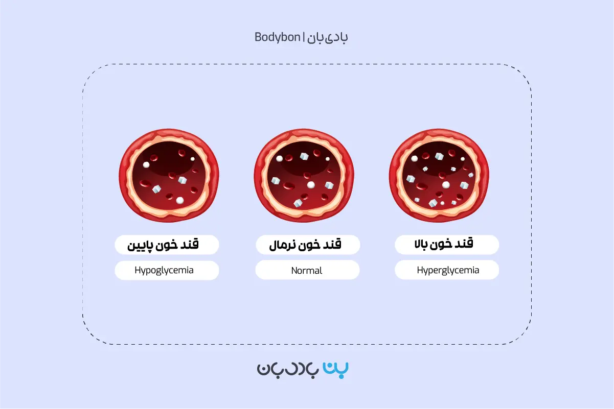 تفسیر آزمایش قند خون ناشتا یا آزمایش FBS 3 قند خون بالای 126 mg/dl در تفسیر آزمایش قند خون ناشتا نشانه قند خون بالا یا هایپرگلوسمی است.