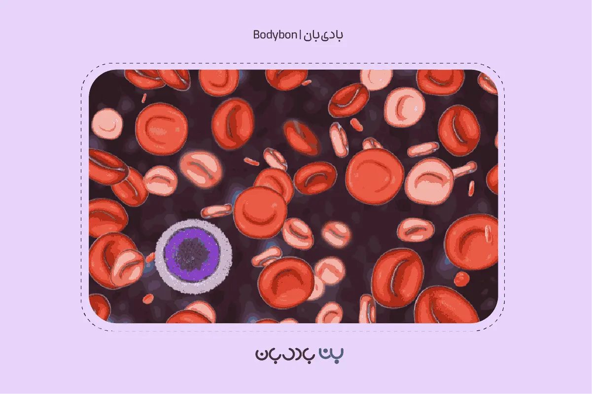 کمخونی داسیشکل چیست؟ علائم، روشهای تشخیص و جدیدترین درمانها 2 iron deficiency anemia 2 1
